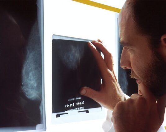 Can cancer be seen on an x-ray?