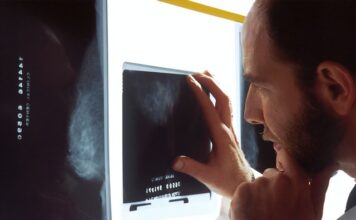 Can cancer be seen on an x-ray?
